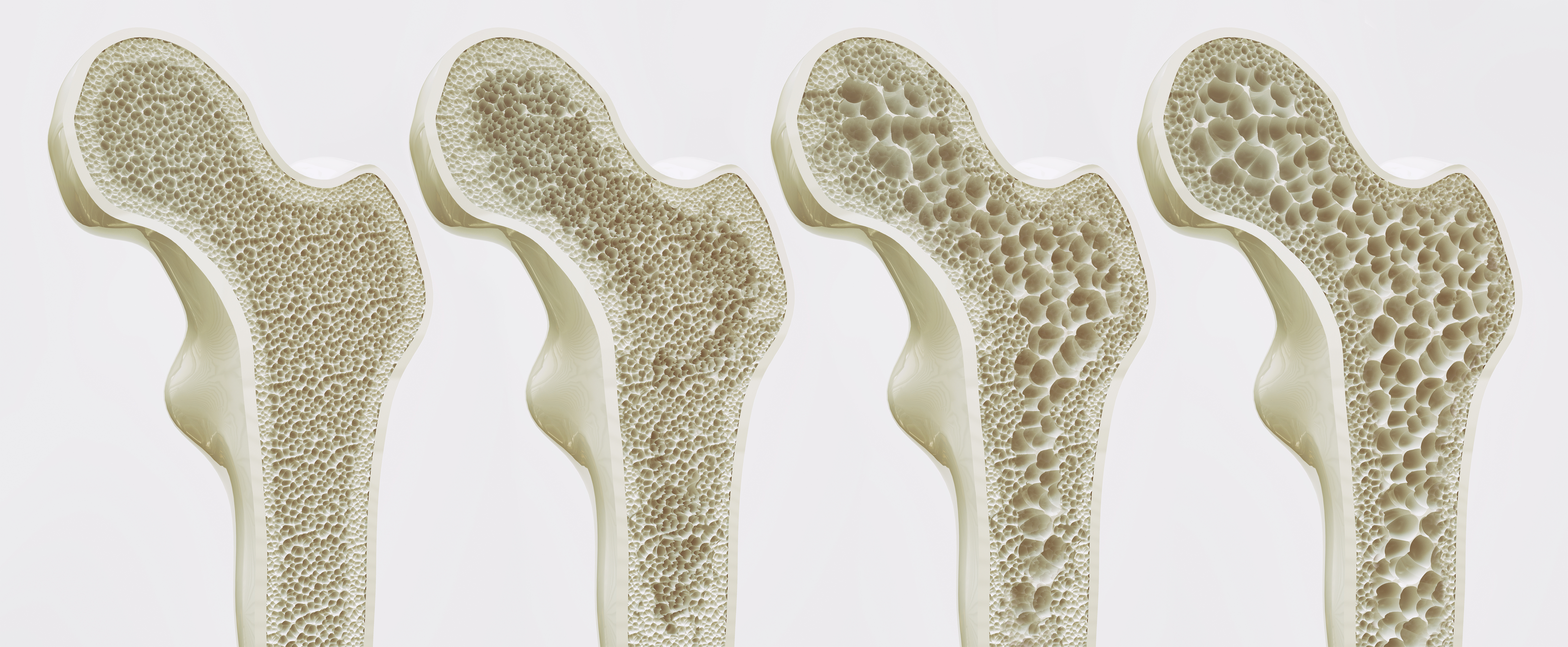 Why Bone Health is SO Important as we Age